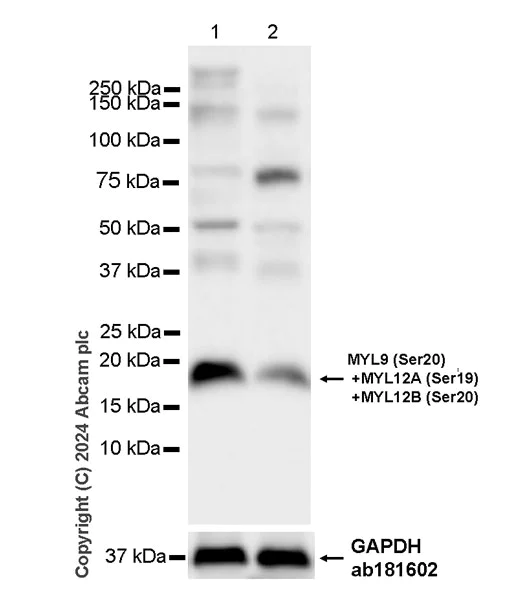 Western blot - Anti-MYL9 (pS20) + MYL12A (pS19) + MYL12B (pS20) antibody [EPR27203-65] - BSA and Azide free (AB316751)