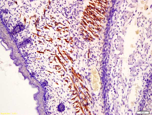 Immunohistochemistry (Formalin/PFA-fixed paraffin-embedded sections) - Anti-MYLPF antibody (AB214313)