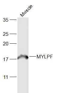Western blot - Anti-MYLPF antibody (AB214313)
