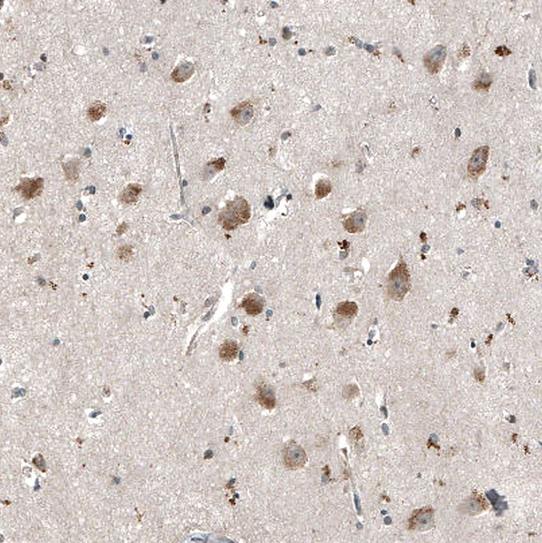 Immunohistochemistry (Formalin/PFA-fixed paraffin-embedded sections) - Anti-MYO10 Antibody [CL9032] (AB327127)