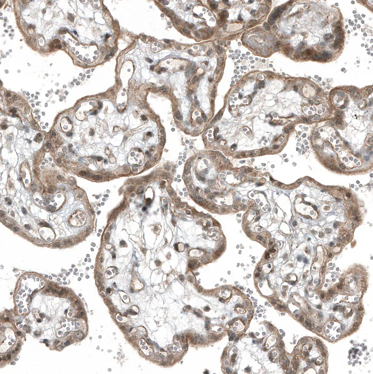 Immunohistochemistry (Formalin/PFA-fixed paraffin-embedded sections) - Anti-MYO10 Antibody [CL9032] (AB327127)