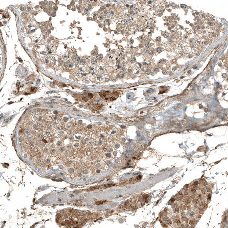 Immunohistochemistry (Formalin/PFA-fixed paraffin-embedded sections) - Anti-MYO10 Antibody [CL9032] (AB327127)
