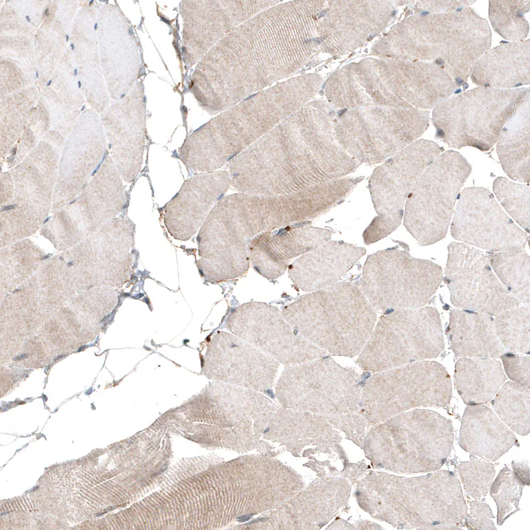 Immunohistochemistry (Formalin/PFA-fixed paraffin-embedded sections) - Anti-MYO10 Antibody [CL9032] (AB327127)