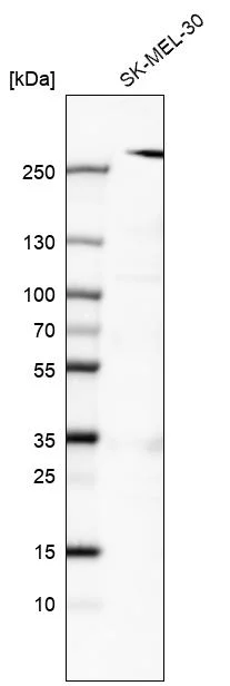 Western blot - Anti-MYO10 Antibody [CL9032] (AB327127)