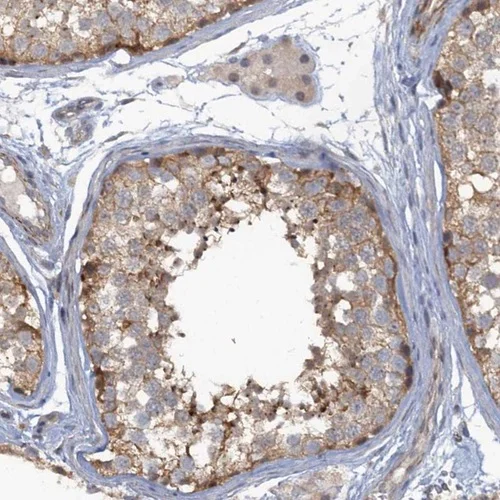 Immunohistochemistry (Formalin/PFA-fixed paraffin-embedded sections) - Anti-MYO16 antibody (AB122620)