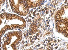 Immunohistochemistry (Formalin/PFA-fixed paraffin-embedded sections) - Anti-MYO1A antibody (AB154518)
