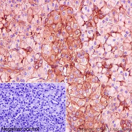 Immunohistochemistry (Formalin/PFA-fixed paraffin-embedded sections) - Anti-MYO1B antibody [EPR16223] (AB194356)
