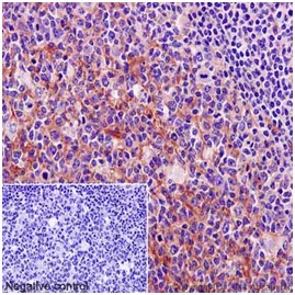 Immunohistochemistry (Formalin/PFA-fixed paraffin-embedded sections) - Anti-MYO1C antibody [EPR14771] (AB194828)