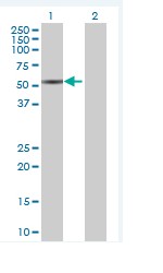 Western blot - Anti-MYO1D antibody (AB70204)