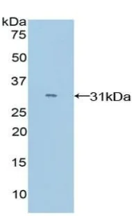 Western blot - Anti-MYO1E antibody (AB231789)