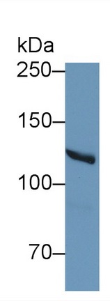 Western blot - Anti-MYO1E antibody (AB231789)