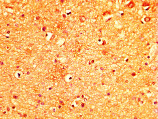 Immunohistochemistry (Formalin/PFA-fixed paraffin-embedded sections) - Anti-MYO5A antibody (AB235003)