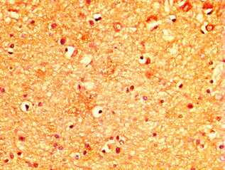Immunohistochemistry (Formalin/PFA-fixed paraffin-embedded sections) - Anti-MYO5A antibody (AB235003)
