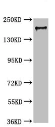 Western blot - Anti-MYO5A antibody (AB235003)