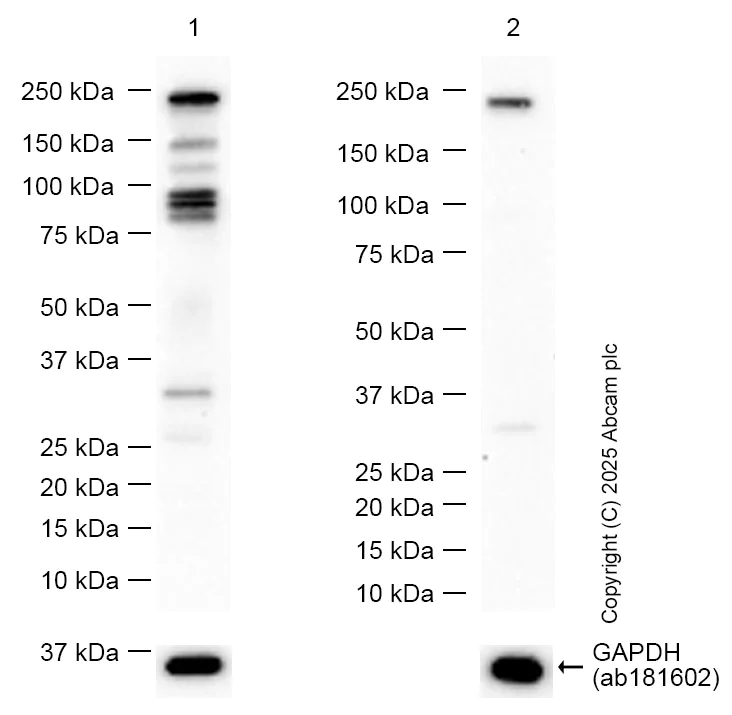 Western blot - Anti-MYO5B antibody [EPR28275-55] (AB313795)