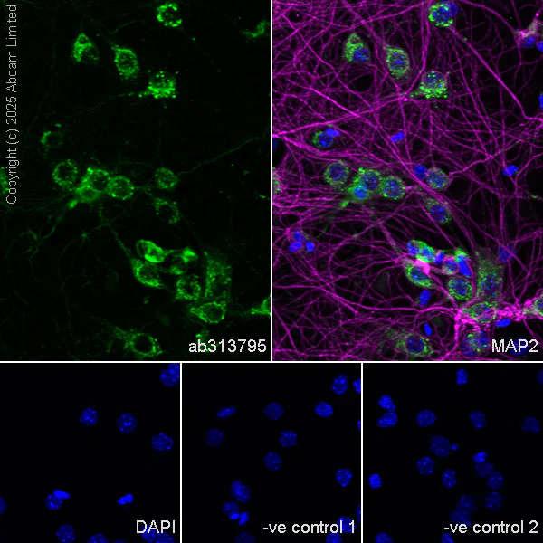 Immunocytochemistry/ Immunofluorescence - Anti-MYO5B antibody [EPR28275-55] - BSA and Azide free (AB313796)