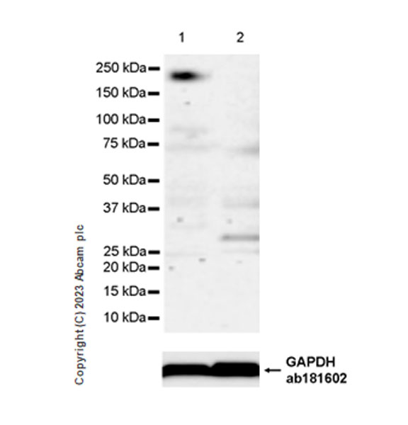 Western blot - Anti-MYO5B antibody [EPR28275-55] - BSA and Azide free (AB313796), expandable thumbnail