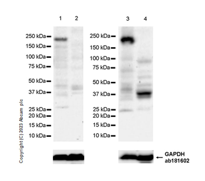Western blot - Anti-MYO5B antibody [EPR28275-55] - BSA and Azide free (AB313796), expandable thumbnail
