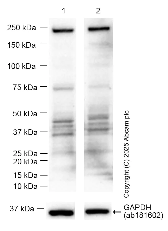Western blot - Anti-MYO5B antibody [EPR28275-55] - BSA and Azide free (AB313796)