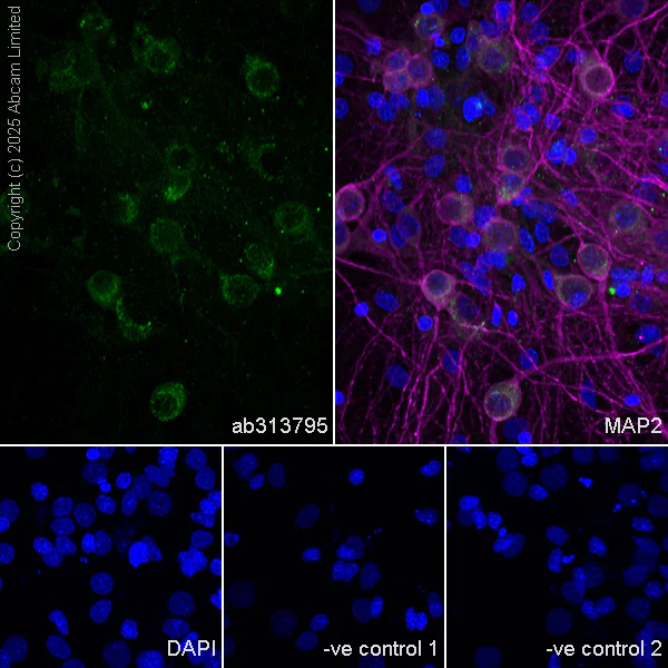 Western blot - Anti-MYO5B antibody [EPR28275-55] - BSA and Azide free (AB313796)