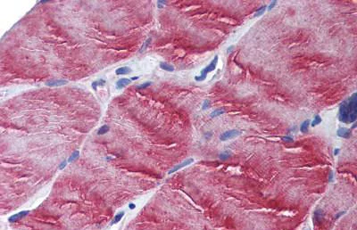 Immunohistochemistry (Formalin/PFA-fixed paraffin-embedded sections) - Anti-MYO5B antibody - N-terminal (AB190096)
