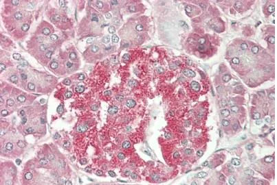 Immunohistochemistry (Formalin/PFA-fixed paraffin-embedded sections) - Anti-MYO6 antibody (AB230478)