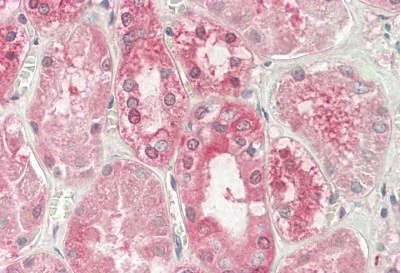 Immunohistochemistry (Formalin/PFA-fixed paraffin-embedded sections) - Anti-MYO6 antibody (AB230478)