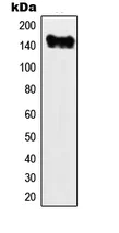 Western blot - Anti-MYO6 antibody (AB230478)