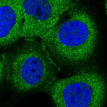 Immunocytochemistry/ Immunofluorescence - Anti-MYO9B antibody (AB243451)