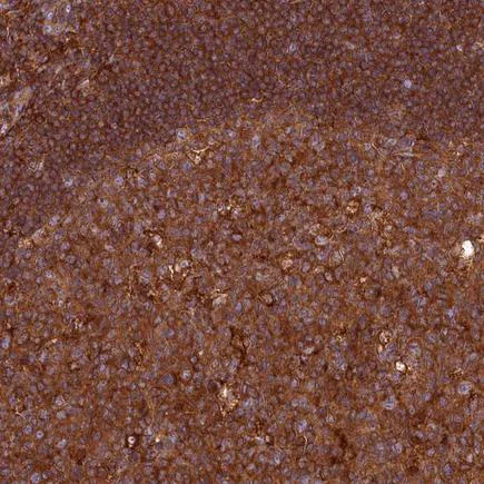 Immunohistochemistry (Formalin/PFA-fixed paraffin-embedded sections) - Anti-MYO9B antibody (AB243451)