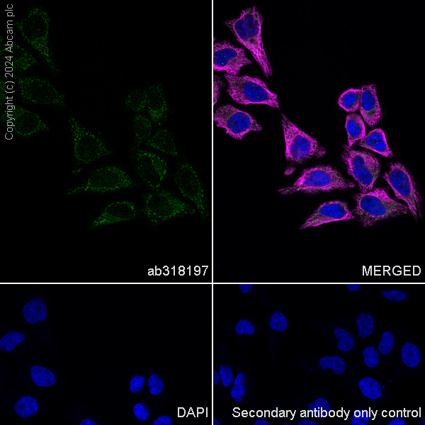 Immunocytochemistry/ Immunofluorescence - Anti-Myocilin antibody [EPR28799-15] - BSA and Azide free (ab318198), expandable thumbnail