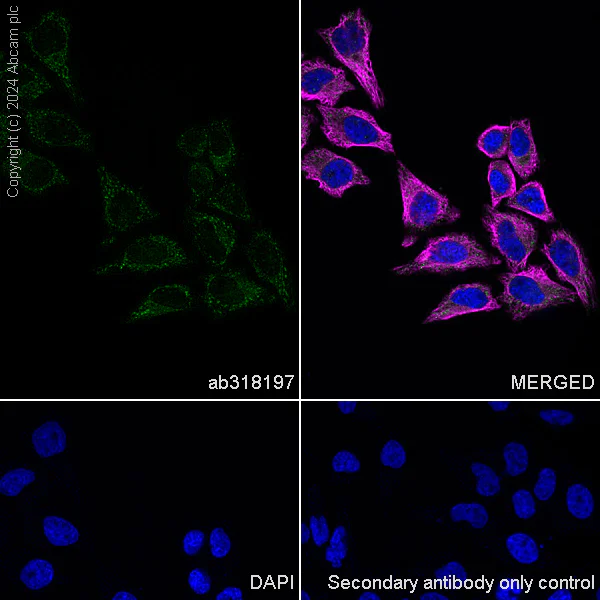 Immunocytochemistry/ Immunofluorescence - Anti-Myocilin antibody [EPR28799-15] - BSA and Azide free (AB318198)