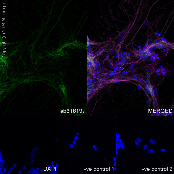 Immunocytochemistry/ Immunofluorescence - Anti-Myocilin antibody [EPR28799-15] - BSA and Azide free (AB318198), expandable thumbnail