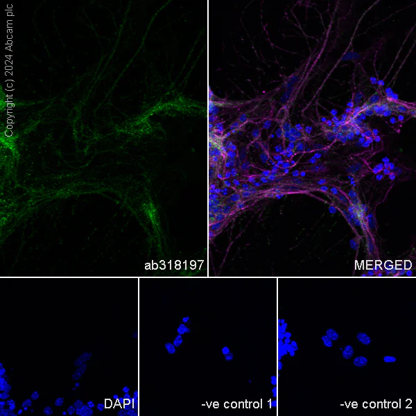 Immunocytochemistry/ Immunofluorescence - Anti-Myocilin antibody [EPR28799-15] - BSA and Azide free (AB318198)