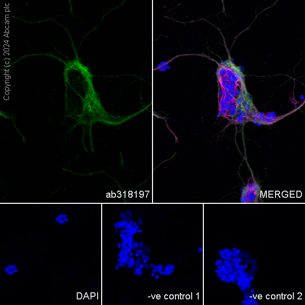 Immunocytochemistry/ Immunofluorescence - Anti-Myocilin antibody [EPR28799-15] - BSA and Azide free (AB318198), expandable thumbnail