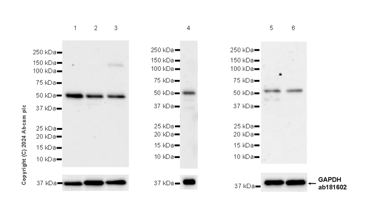 Western blot - Anti-Myocilin antibody [EPR28799-15] - BSA and Azide free (AB318198)