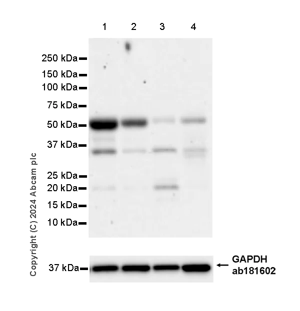 Western blot - Anti-Myocilin antibody [EPR28799-15] - BSA and Azide free (AB318198)