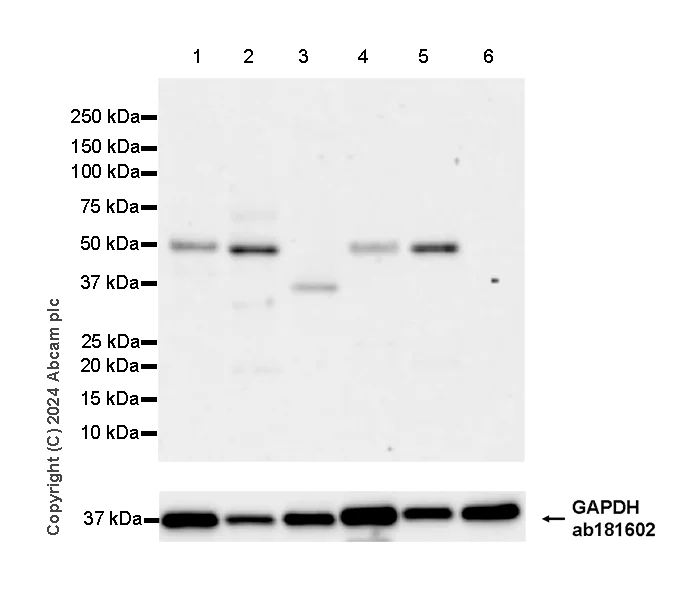 Western blot - Anti-Myocilin antibody [EPR28799-15] - BSA and Azide free (AB318198)