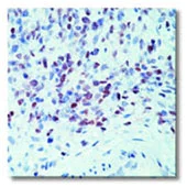 Immunohistochemistry (Formalin/PFA-fixed paraffin-embedded sections) - Anti-MyoD1 antibody [5.2F] (AB16148)