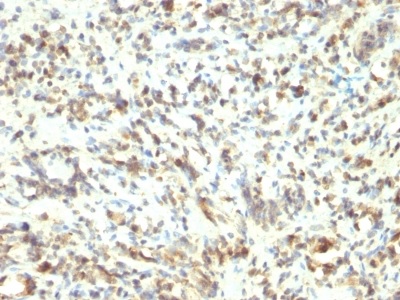 Immunohistochemistry (Formalin/PFA-fixed paraffin-embedded sections) - Anti-MyoD1 antibody [5.8A] (AB233941), expandable thumbnail