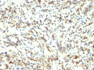 Immunohistochemistry (Formalin/PFA-fixed paraffin-embedded sections) - Anti-MyoD1 antibody [5.8A] (AB233941)