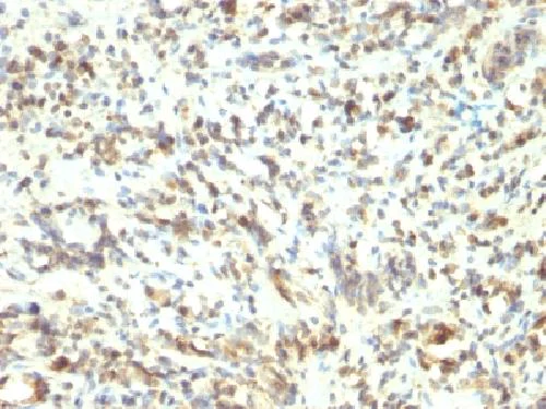 Immunohistochemistry (Formalin/PFA-fixed paraffin-embedded sections) - Anti-MyoD1 antibody [5.8A] - BSA free (AB212662)