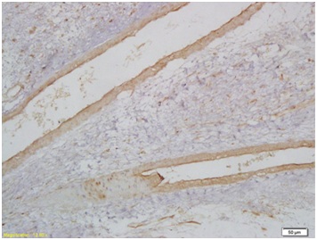 Immunohistochemistry (Formalin/PFA-fixed paraffin-embedded sections) - Anti-MyoD1 antibody (AB203383)