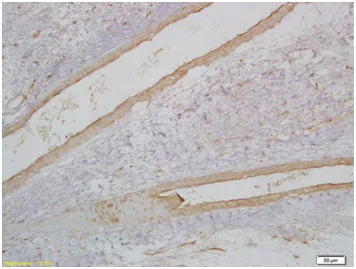 Immunohistochemistry (Formalin/PFA-fixed paraffin-embedded sections) - Anti-MyoD1 antibody (AB203383)