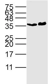 Western blot - Anti-MyoD1 antibody (AB203383)