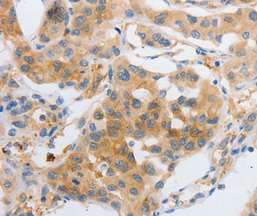 Immunohistochemistry (Formalin/PFA-fixed paraffin-embedded sections) - Anti-MyoD1 antibody - C-terminal (AB198251)