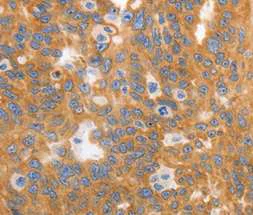 Immunohistochemistry (Formalin/PFA-fixed paraffin-embedded sections) - Anti-MyoD1 antibody - C-terminal (AB198251)