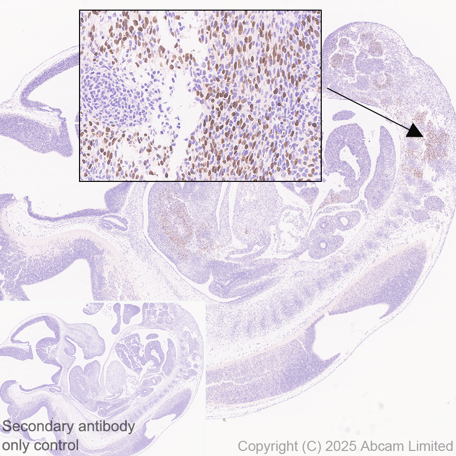 Immunohistochemistry (Formalin/PFA-fixed paraffin-embedded sections) - Anti-MyoD1 antibody [EPR29627-738] (AB323377), expandable thumbnail