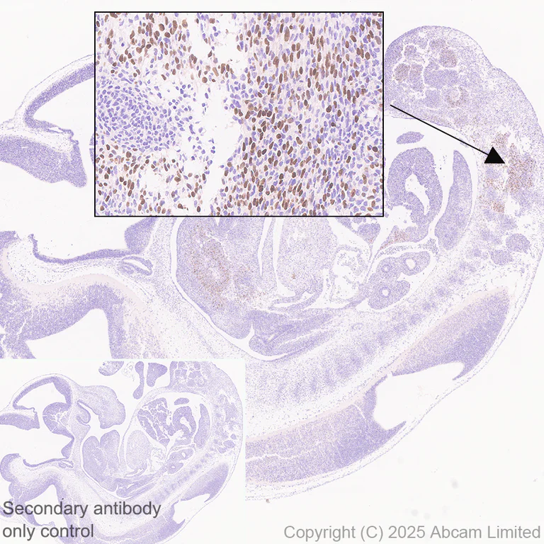 Immunohistochemistry (Formalin/PFA-fixed paraffin-embedded sections) - Anti-MyoD1 antibody [EPR29627-738] (AB323377)