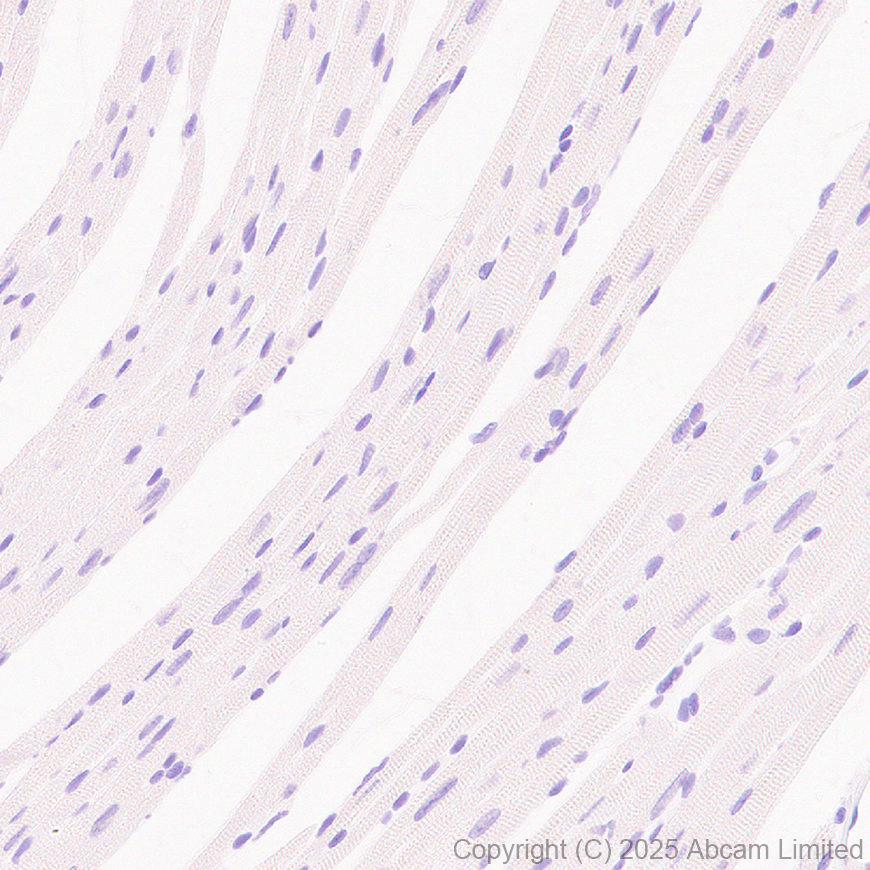 Immunohistochemistry (Formalin/PFA-fixed paraffin-embedded sections) - Anti-MyoD1 antibody [EPR29627-738] (AB323377), expandable thumbnail